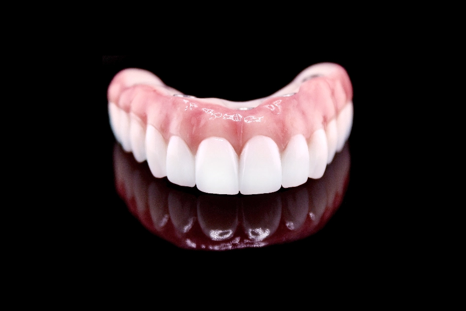 Definitive Restorations
