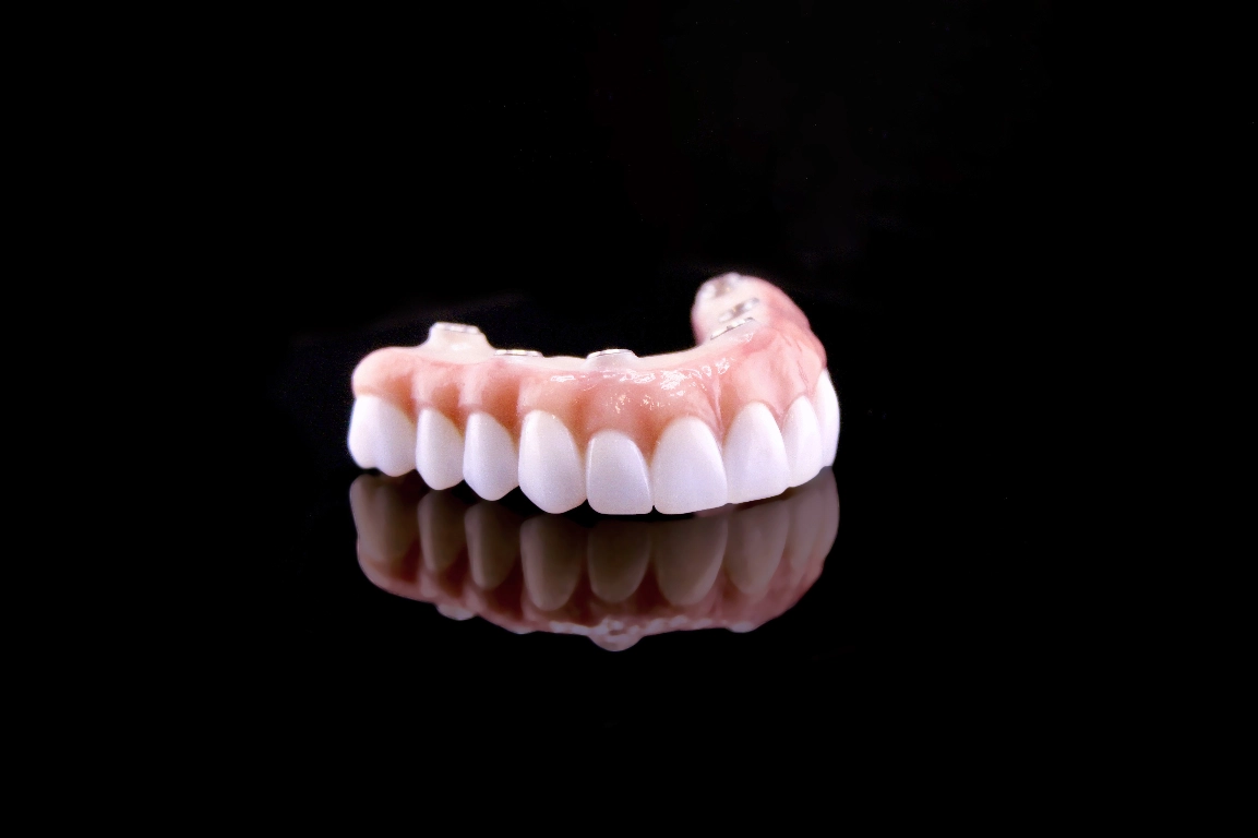 Definitive Restorations