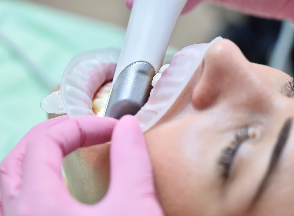 Selecting the Right Intraoral Scanner 