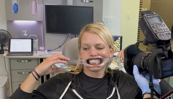 Clear Aligners: Essential Records for Treatment Planning 