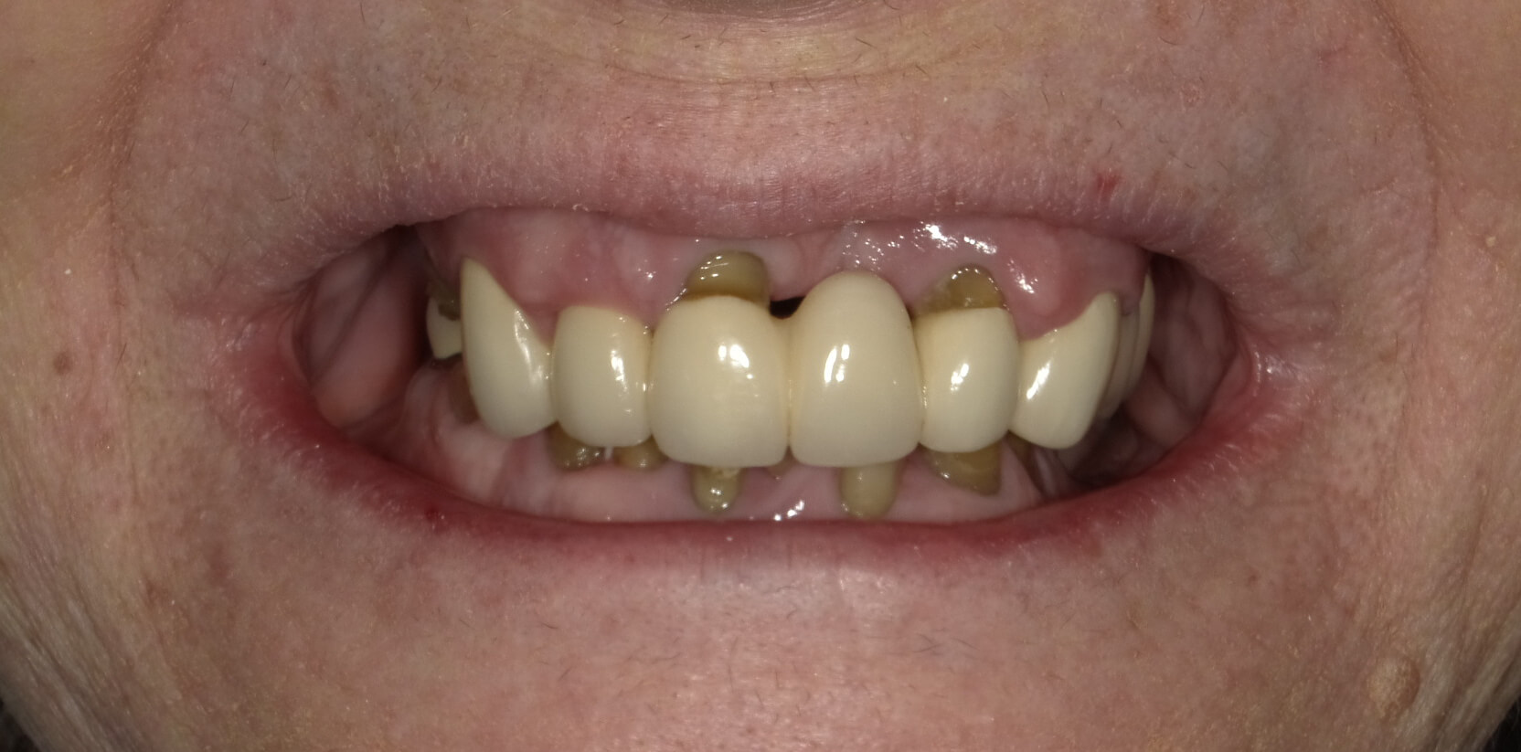 Before
