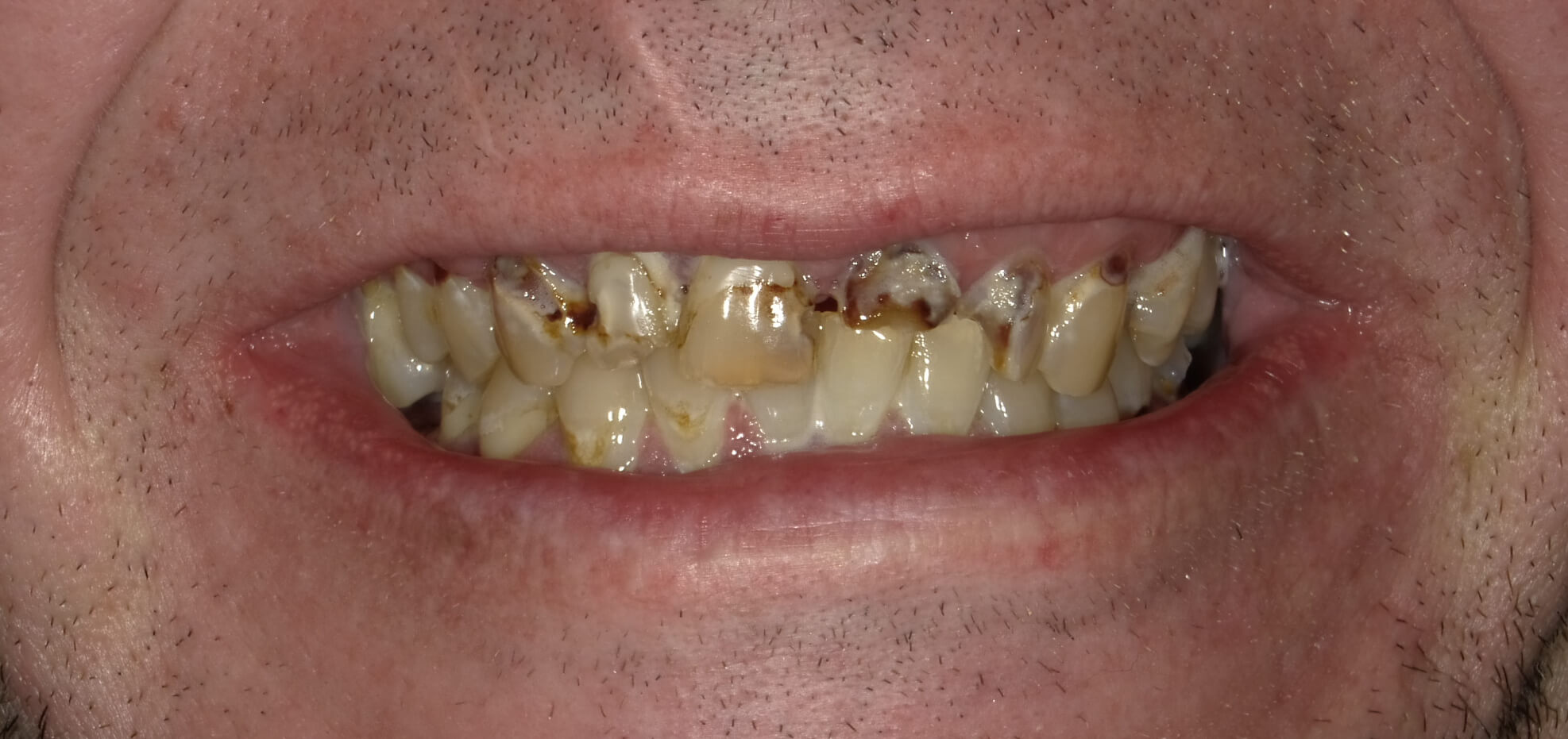 Before