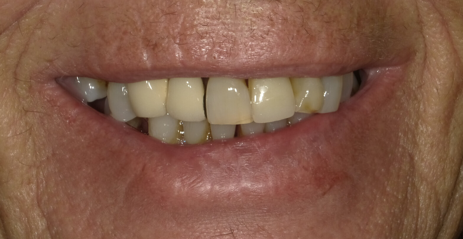 Before